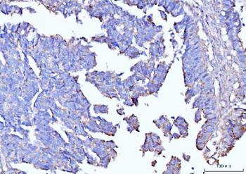 Anti-Moesin/MSN Antibody (monoclonal, 8D4)