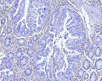 Anti-Moesin/MSN Antibody (monoclonal, 8D4)