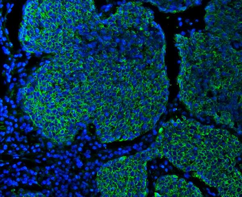 Anti-Cytokeratin 5 Antibody (monoclonal, 5D3F7)