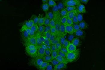 Anti-Cytokeratin 5 Antibody (monoclonal, 5D3F7)