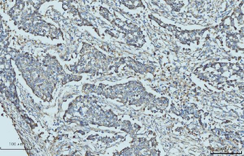 Anti-Cytokeratin 5 Antibody (monoclonal, 5D3F7)