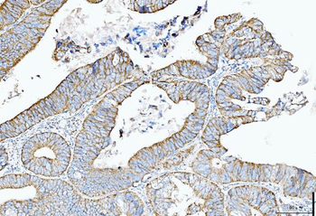 Anti-Cytokeratin 5 Antibody (monoclonal, 5D3F7)