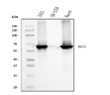 Anti-Cytokeratin 5 Antibody (monoclonal, 5D3F7)