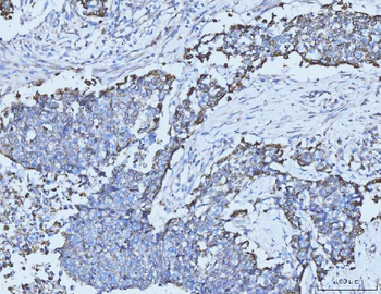 Anti-Cytokeratin 5 Antibody (monoclonal, 9H2F8)