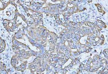 Anti-Cytokeratin 5 Antibody (monoclonal, 9H2F8)