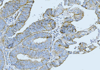 Anti-Cytokeratin 5 Antibody (monoclonal, 9H2F8)