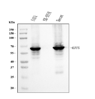 Anti-Cytokeratin 5 Antibody (monoclonal, 9H2F8)