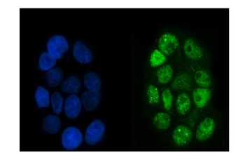 Anti-p95 NBS1 Antibody (monoclonal, 5D7A1)