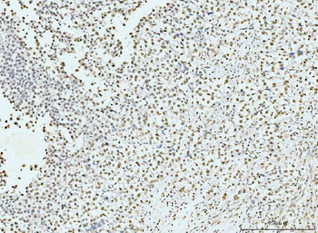 Anti-p95 NBS1 Antibody (monoclonal, 5D7A1)