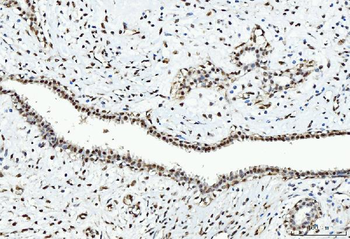 Anti-CTBP2 Antibody (monoclonal, 10E9D2)