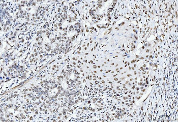 Anti-CTBP2 Antibody (monoclonal, 10E9D2)