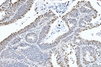 Anti-CTBP2 Antibody (monoclonal, 10E9D2)