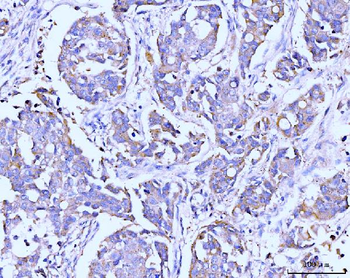 Anti-ITCH/AIP4 Antibody (monoclonal, 5E12)