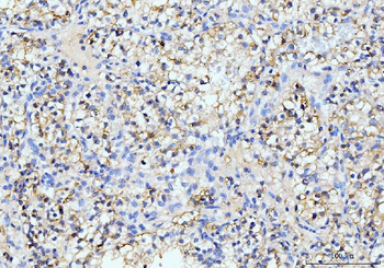 Anti-ITCH/AIP4 Antibody (monoclonal, 5E12)