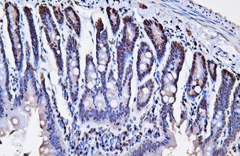 PCNA Antibody (monoclonal, 2G2)