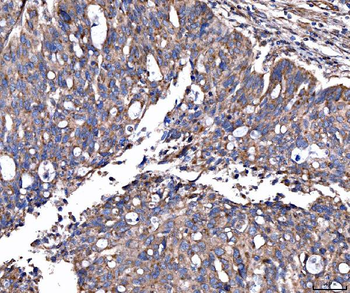 Anti-MRP3/ABCC3 Antibody