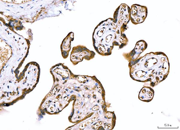 Anti-MRP3/ABCC3 Antibody