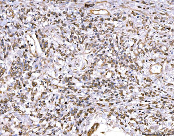 Anti-MRP3/ABCC3 Antibody