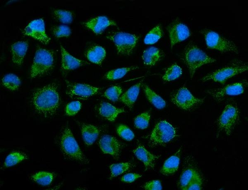 Anti-ACADM/MCAD Antibody