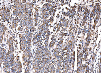 Anti-ACADM/MCAD Antibody