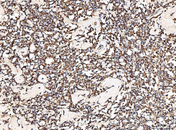 Anti-ACADM/MCAD Antibody