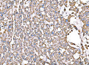 Anti-ACADM/MCAD Antibody