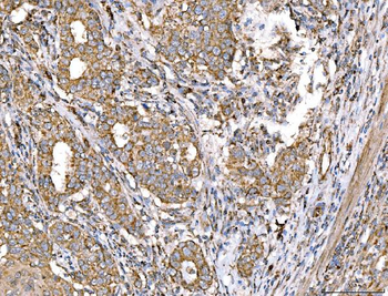 Anti-ACADM/MCAD Antibody