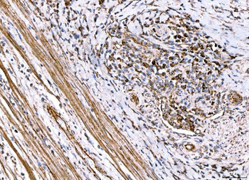 Anti-ACADM/MCAD Antibody