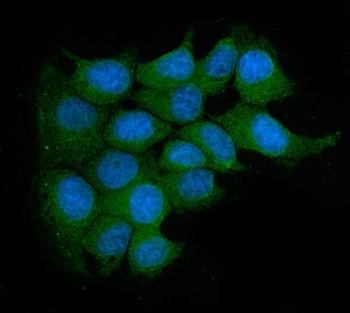 Anti-Acid phosphatase/ACP5 Antibody
