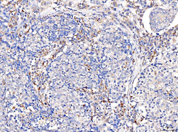 Anti-Acid phosphatase/ACP5 Antibody