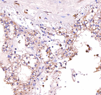 Anti-Acid phosphatase/ACP5 Antibody