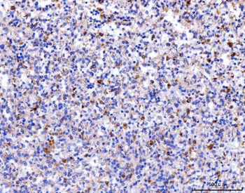 Anti-Acid phosphatase/ACP5 Antibody