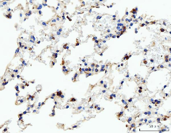 Anti-Acid phosphatase/ACP5 Antibody