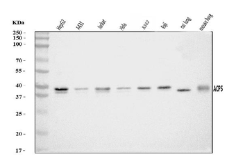 Anti-Acid phosphatase/ACP5 Antibody
