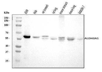 Anti-ALDH3A1 Antibody