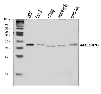 Anti-ARL6IP6 Antibody