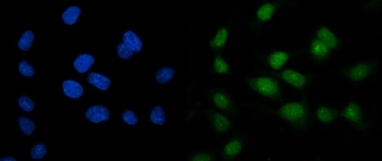 Anti-ARL6IP6 Antibody