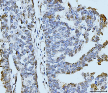 Anti-ARL6IP6 Antibody