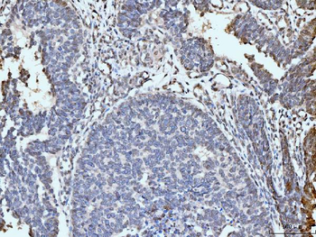 Anti-ARL6IP6 Antibody