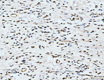 Anti-ARL6IP6 Antibody