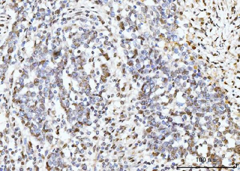 Anti-ARL6IP6 Antibody