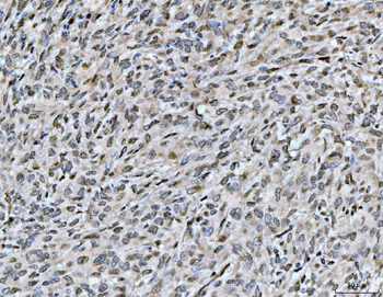 Anti-ARL6IP6 Antibody