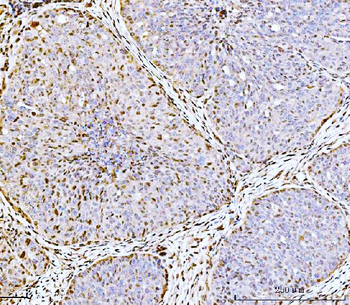 Anti-ARL6IP6 Antibody