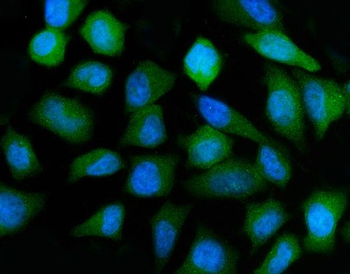 Anti-ATP6V1A Antibody