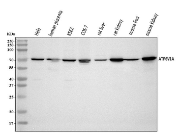 Anti-ATP6V1A Antibody