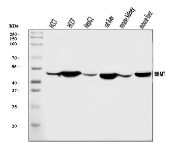 Anti-BHMT Antibody