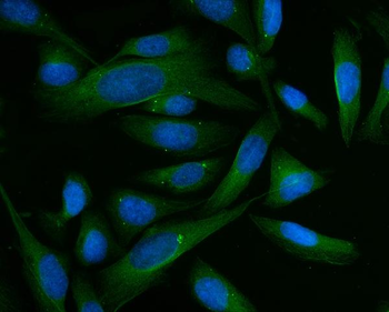 Anti-BHMT Antibody