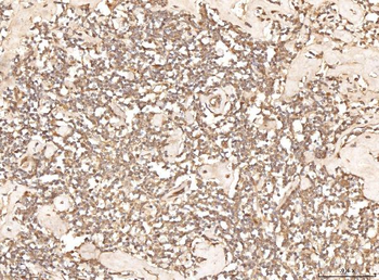 Anti-BHMT Antibody