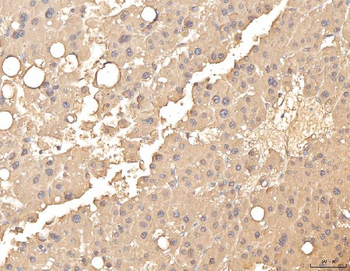 Anti-BHMT Antibody
