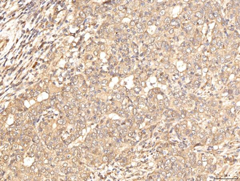 Anti-BHMT Antibody